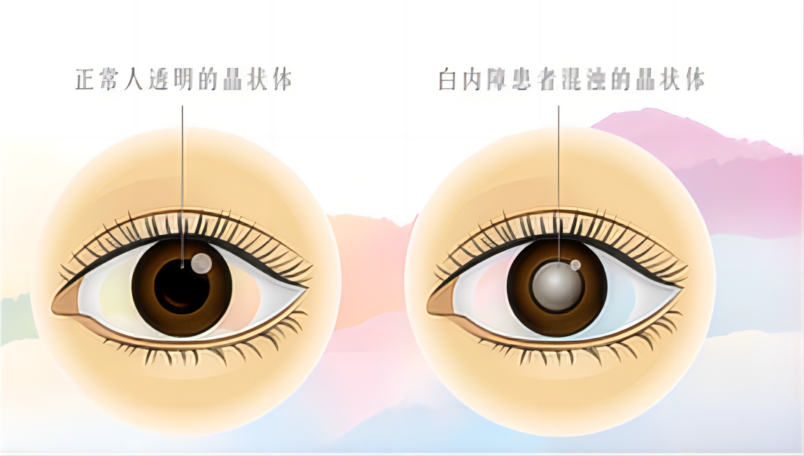 81f94443f0c30c946498bfef3f22f51.png